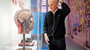 Senckenberg gibt Einblick in Charly Körbels Gehirn