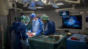 Wie die Schweiz die Zahl der Organspender steigern will