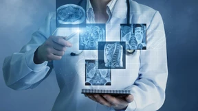 Innovative Vorsorge fürs Depot