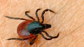 Mehr FSME-Fälle in Hessen