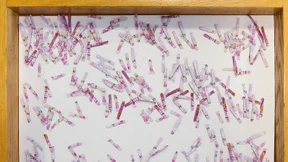 Wenn die Banknote ramponiert ist