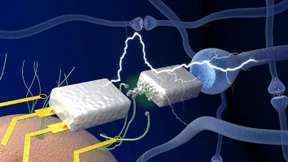 Eine reine Nervensache