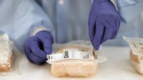 „AMR könnte tödlicher sein als Krebs“