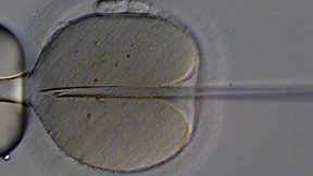 „Social Freezing“ in Osteuropa