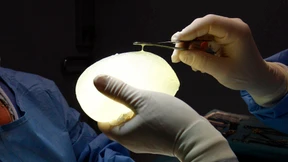 „Es geht nicht um seltene Einzelfälle“