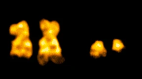 Hoffnung für Patienten mit seltener Leukämie