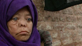 Das unverschämte Gesicht der Armut