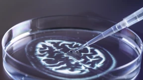 Wie Alzheimer-Biomarker die Therapie verbessern sollen