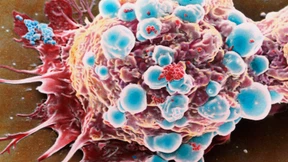 Wettlauf gegen den Krebs