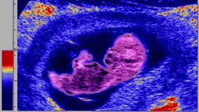 Das unausgesprochene Risiko