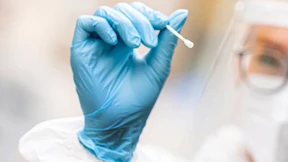 Sieben-Tage-Inzidenz steigt – 11.561 Neuinfektionen