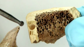 Die Frühgeschichte Ozeaniens umschreiben?