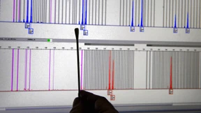„Bestes Werkzeug forensischer Genetik“