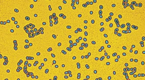 Wie Bakterien Antibiotikaresistenzen weitergeben