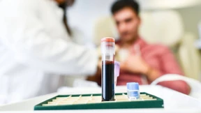 Eine Pipeline mit viel Variation