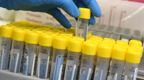 Sieben-Tage-Inzidenz und Neuinfektionen sinken