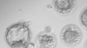 „Das muss sehr aufmerksam beobachtet werden“