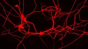 Funktionieren komplizierte Gehirne nach einfachen Regeln?