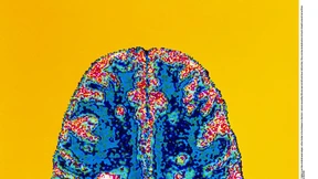 Neue Ideen für die Behandlung von Multipler Sklerose