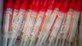 Bayern kündigt Corona-Tests für jedermann an