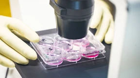 Wieso es mit dem Coronavirus-Impfstoff nicht schneller geht