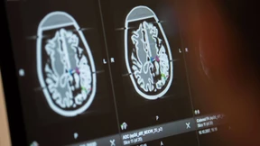 Die Corona-Entgleisungen im Gehirn