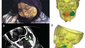 Inka bereiteten Kinder mit Koka und Alkohol auf den Tod vor 