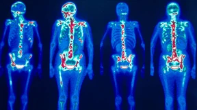 Der neue Kampf gegen den Krebs