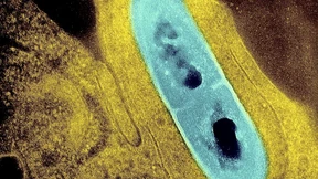 Ein Mensch nach Verzehr von listerienverseuchtem Gemüse gestorben