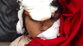 Helfer befürchten Ausbruch von Seuchen