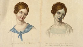 Was wir von der Cholera lernen können