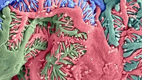 Wie das Coronavirus die Nieren attackiert