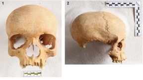 Mittelalterlicher Grabfund gibt Rätsel auf