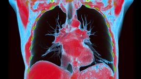 Protein repariert Lunge nach Entzündung