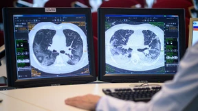 Weder Alarmismus, noch realitätsfremder Leichtsinn