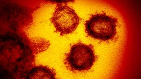 Wie sich jeder vor dem Coronavirus schützen kann