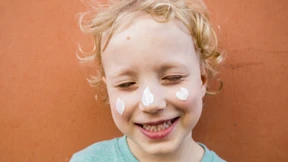 Was kann man tun, wenn Kinderhaut juckt und kratzt?