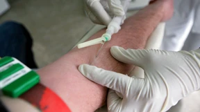 Frühere Therapie von HIV-Infizierten soll Leben retten