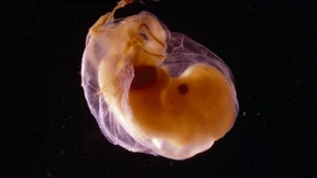 Der Traum vom perfekten Kind kann schnell zum Albtraum werden