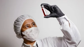 Coronavirus kann vor ersten Symptomen übertragen werden