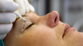 London verbietet Werbung für Schönheits-OPs in Jugendmedien