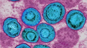 Erster Schritt zu Impfung gegen Cytomegalievirus