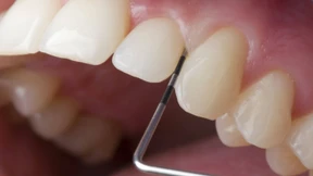 Die Briten hatten zu Zeiten der Römer bessere Zähne