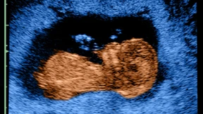 Die frühe Beziehung zum Ungeborenen