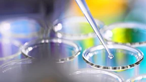 Biotechnologie warnt vor fehlenden Anreizen