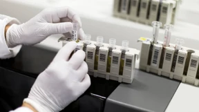 Zahl der HIV-Neuinfektionen leicht gesunken