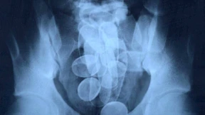 1,3 Kilo Kokain im Magen: 45 Monate Haft