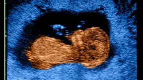 Können Kliniken zu Abtreibungen verpflichtet werden?