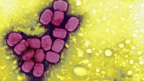 Mit Christian Drosten in Afrika