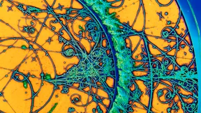 Lieber viele Welten als ein würfelnder Gott